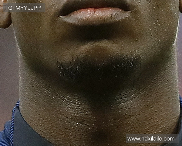 德容罕见暴怒怒斥裁判